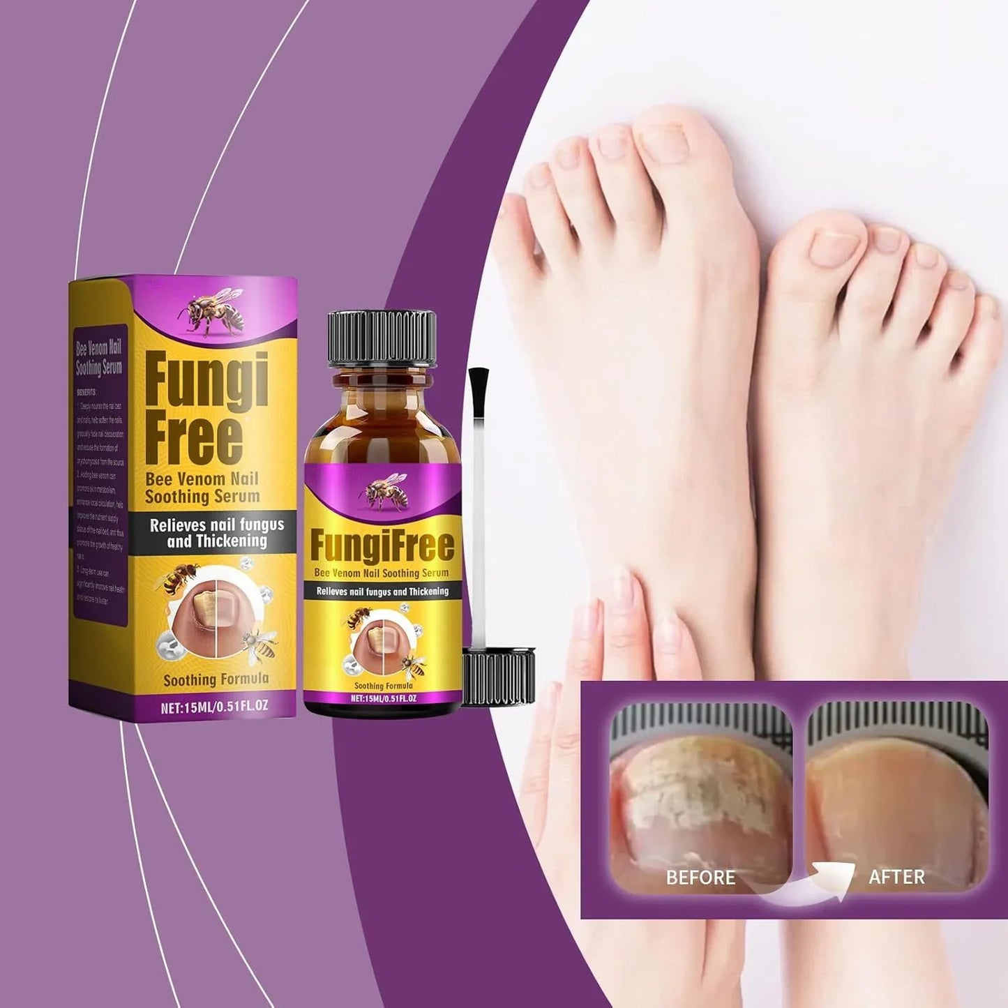 Fungi Free Bee Venom Nail Repair Serum – 15ml | Natural Nail Fungus Treatment & Strengthener