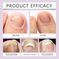 Fungi Free Bee Venom Nail Repair Serum – 15ml | Natural Nail Fungus Treatment & Strengthener