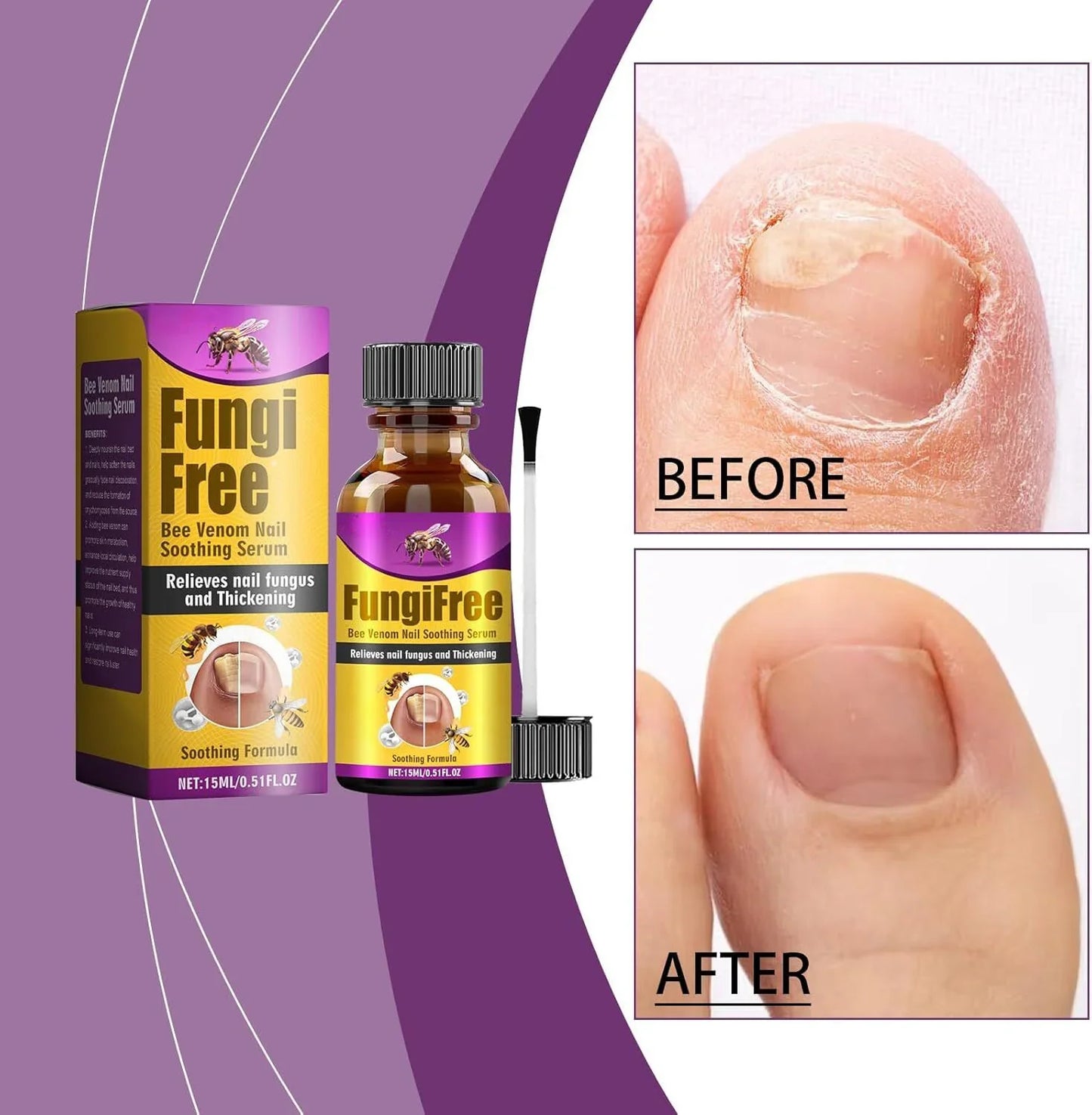 Fungi Free Bee Venom Nail Repair Serum – 15ml | Natural Nail Fungus Treatment & Strengthener